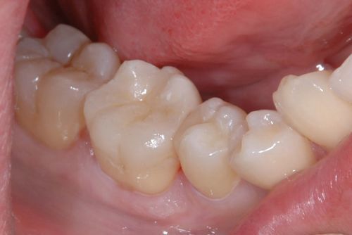4725_18838.jpg
