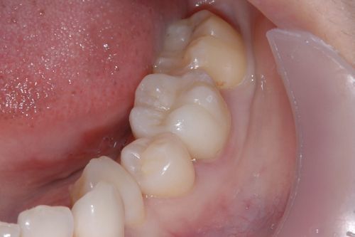 4887_18938.jpg