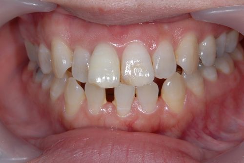 5317_24515.jpg